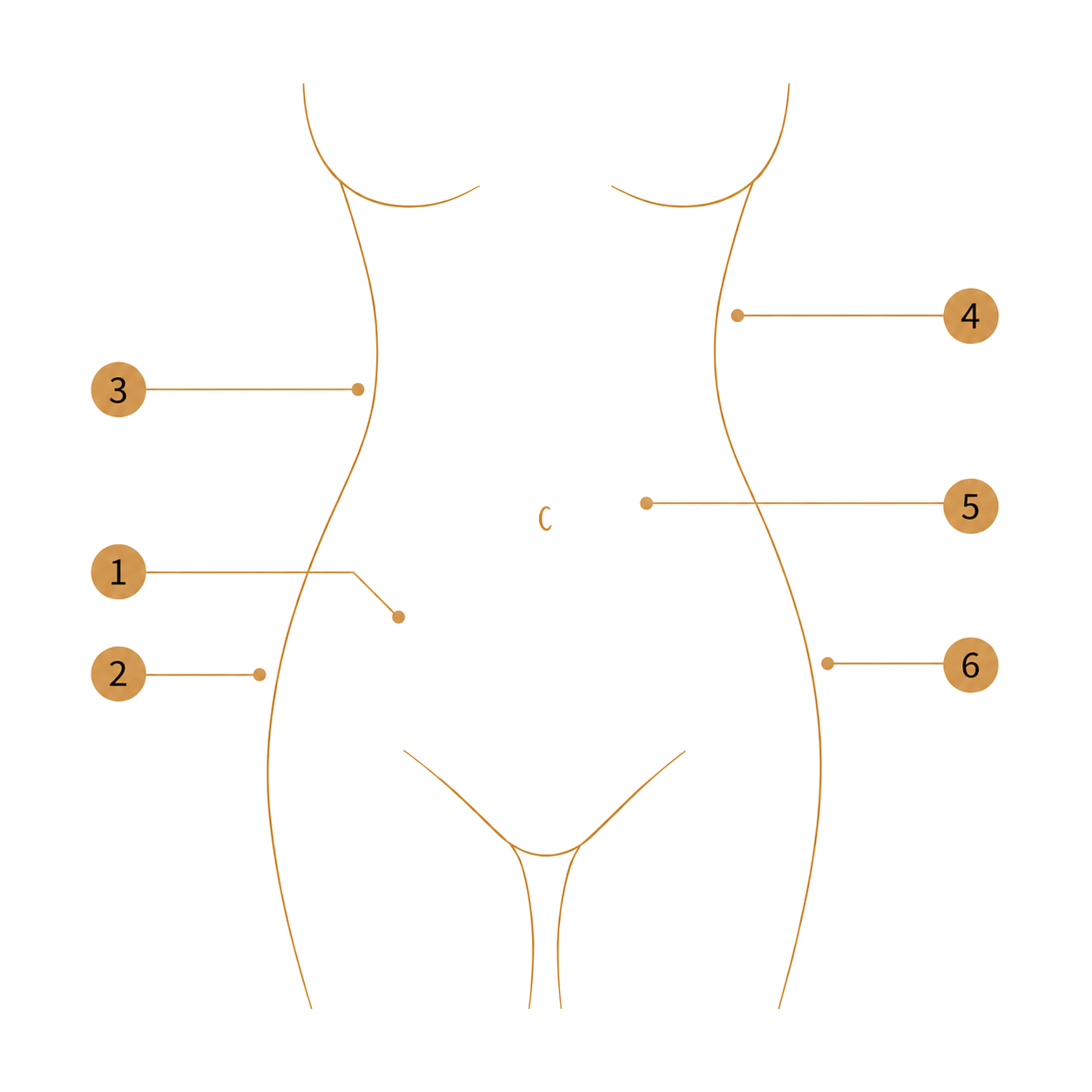 Diagram showing areas that may be addressed with abdominoplasty